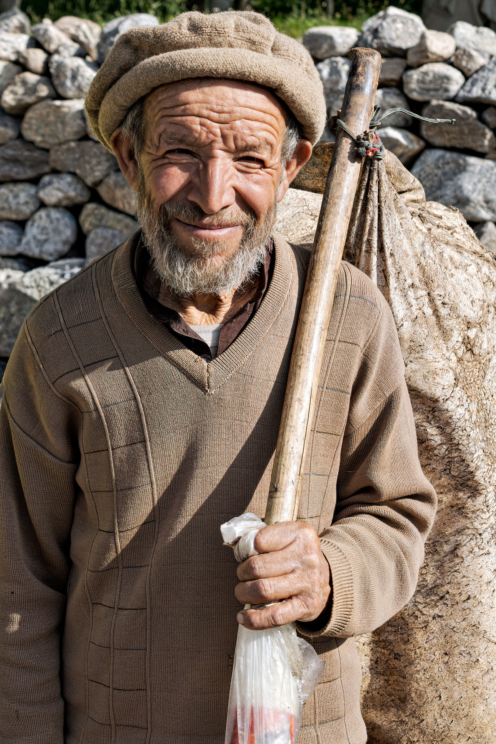 Rupal, l'uomo con la pelle di capra