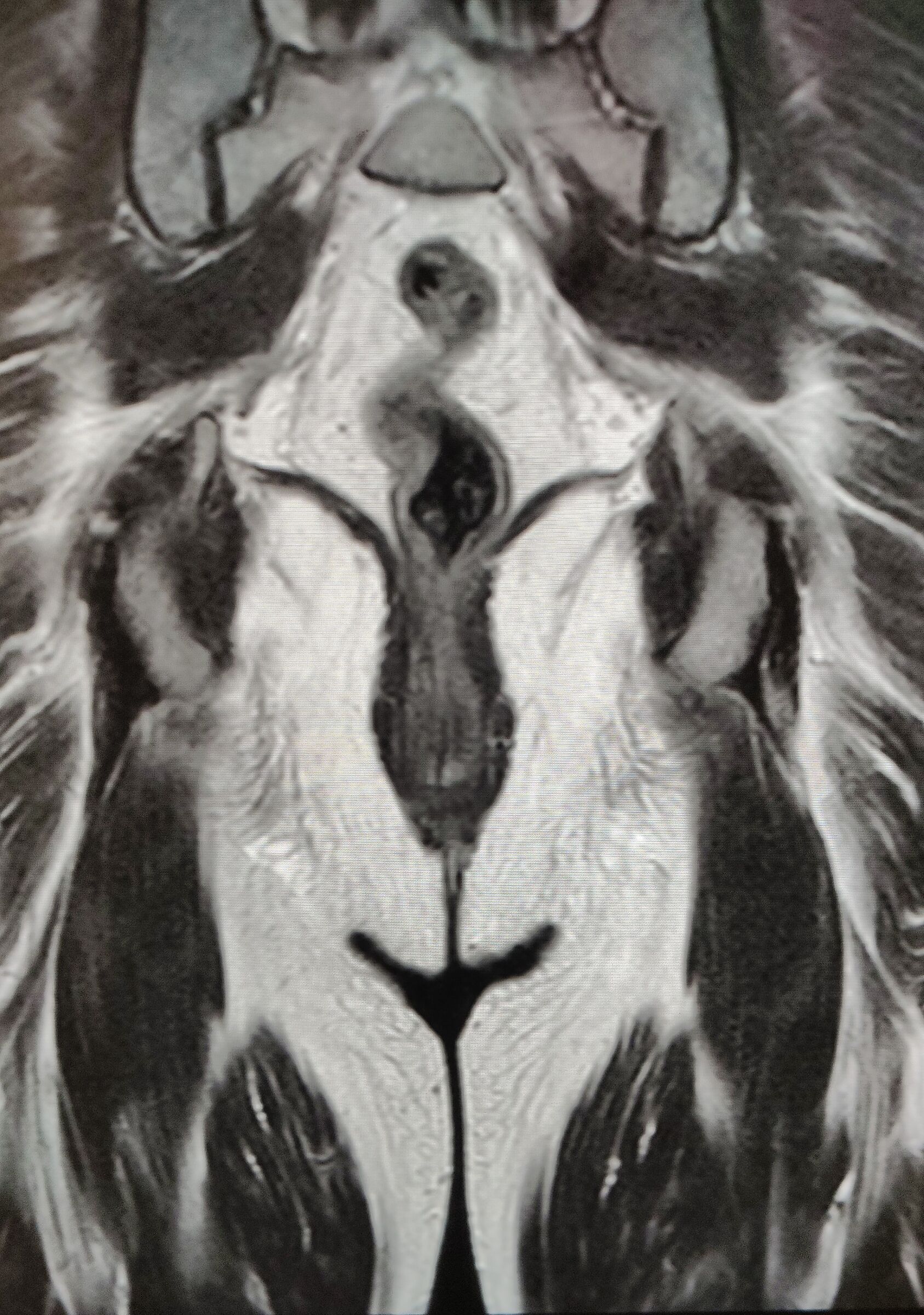 Il Re Leone fa una risonanza magnetica