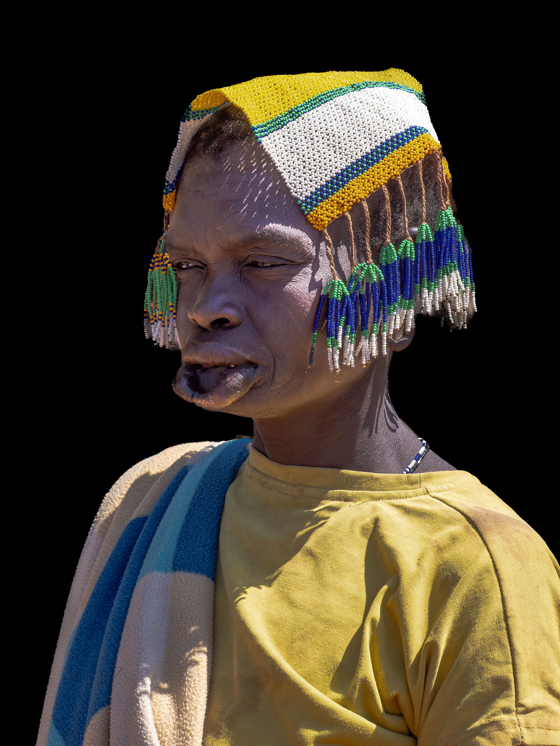 modella per chirurghi estetici occidentali!