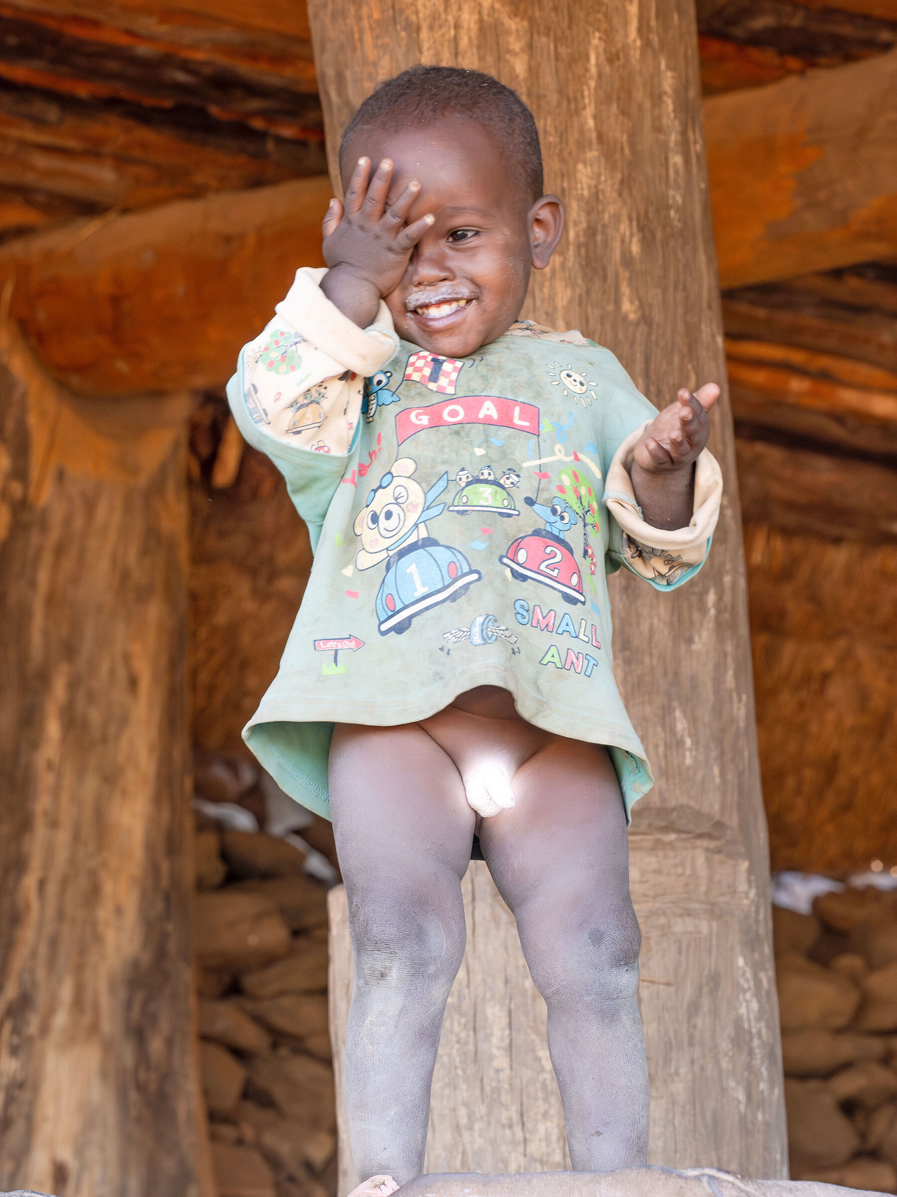 ...si copre dalla parte sbagliata!