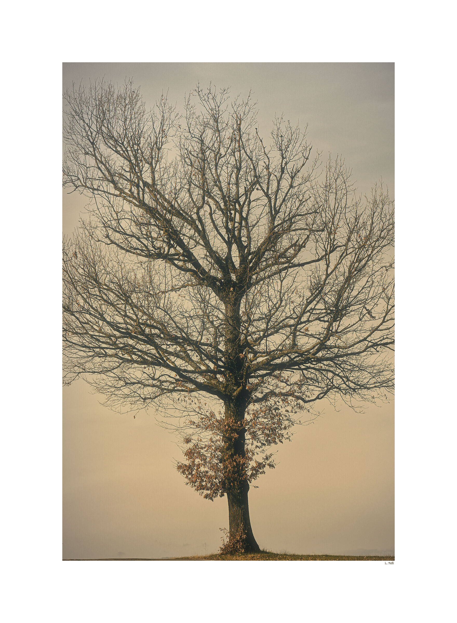 Albero bronchiale