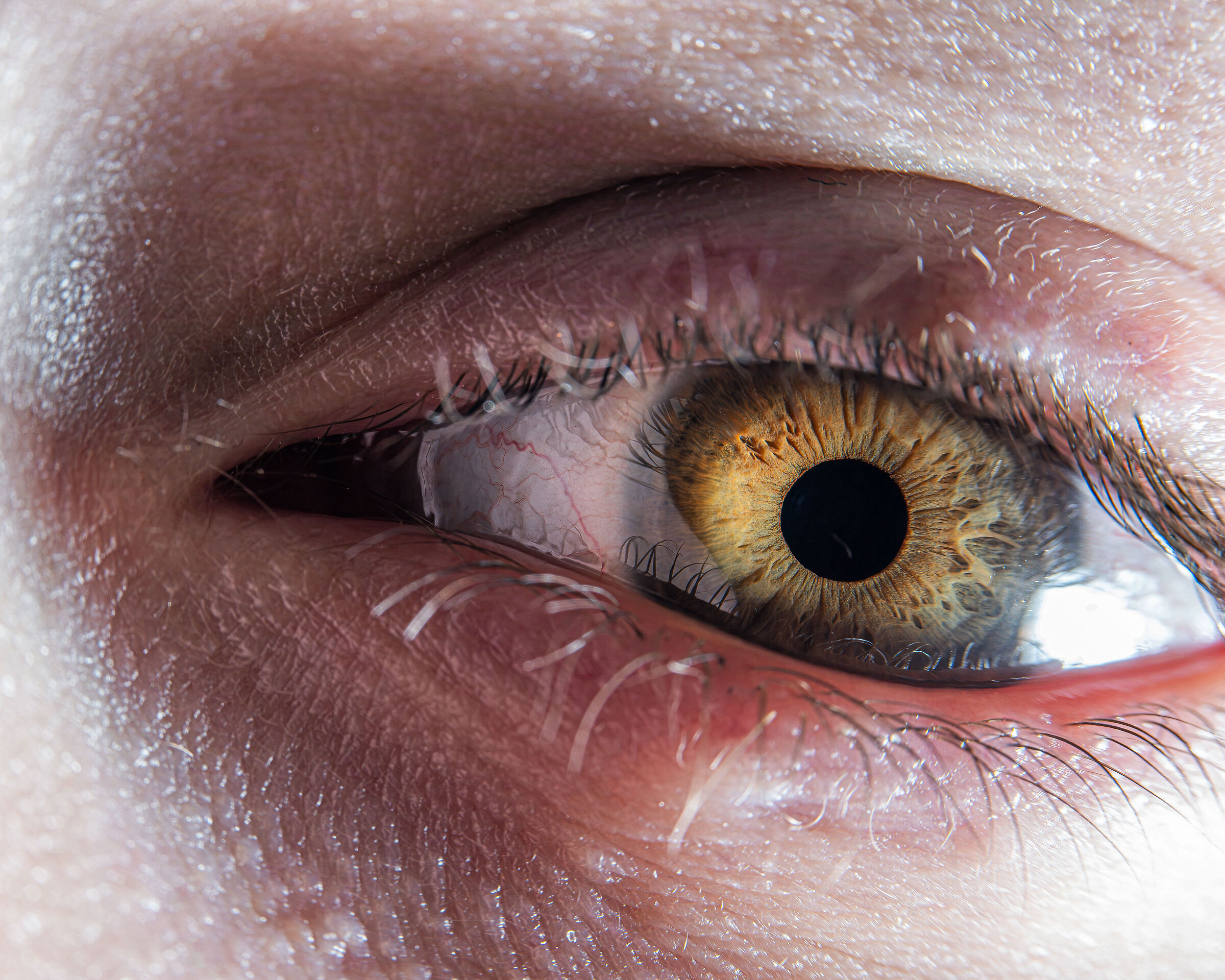 Elisa's Eye