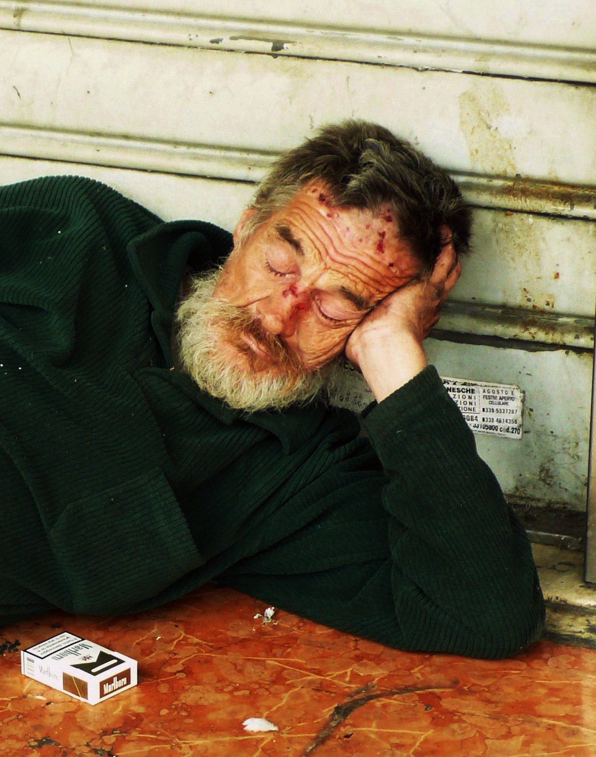 purtroppo uno dei molti