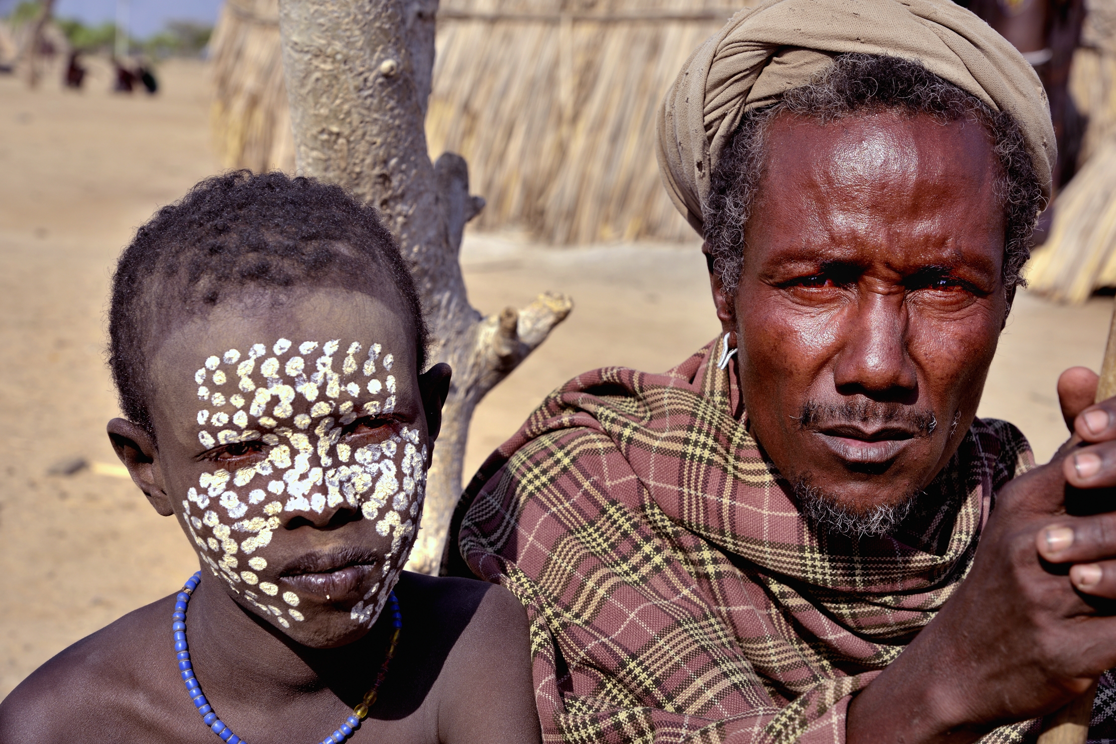 Etiopia 2015 - Erborè