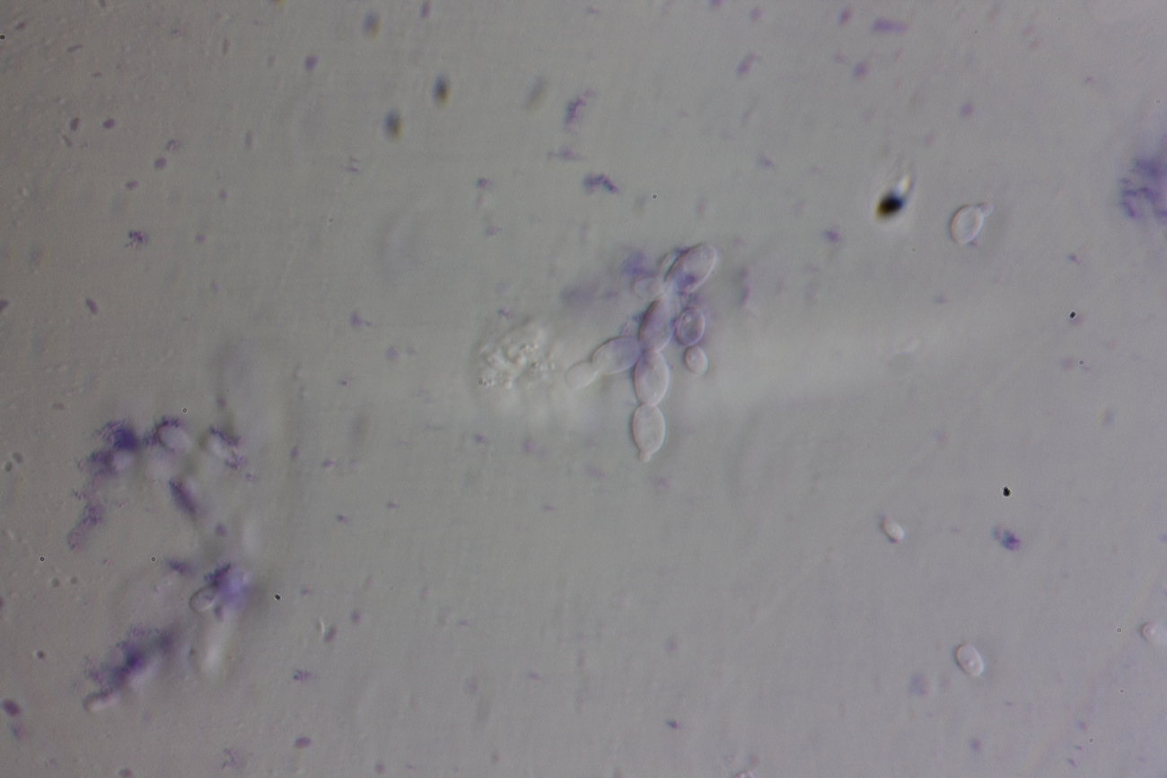 Under a microscope, grapes fermenting the third day1