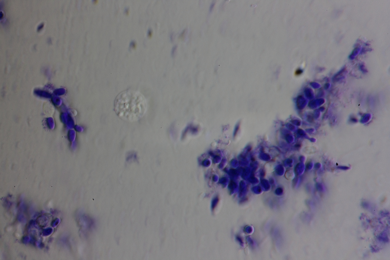 Under a microscope, grapes fermenting on the third day 2