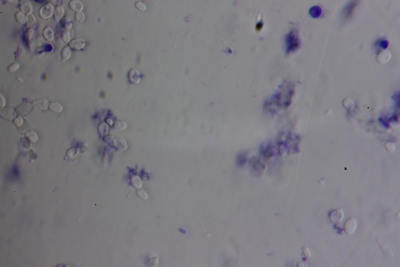 Under a microscope, grapes fermenting on the third day 3