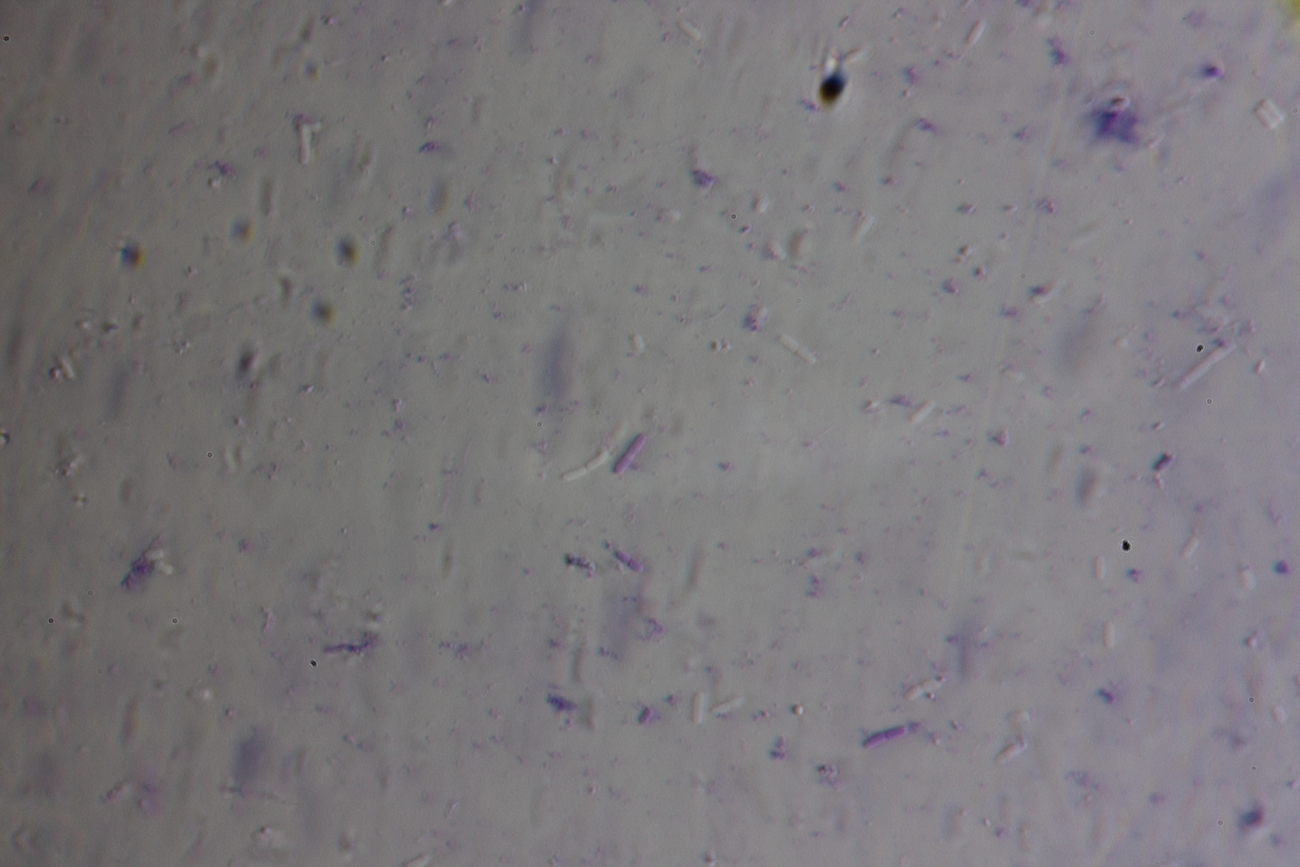 Under a microscope, buckwheat third day1