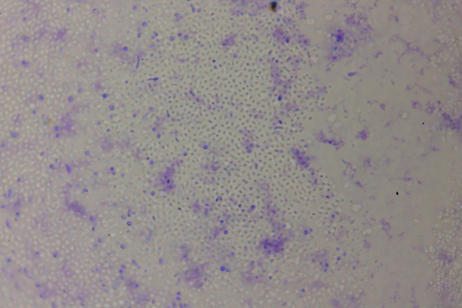 3 Fermented grapes after 2 months