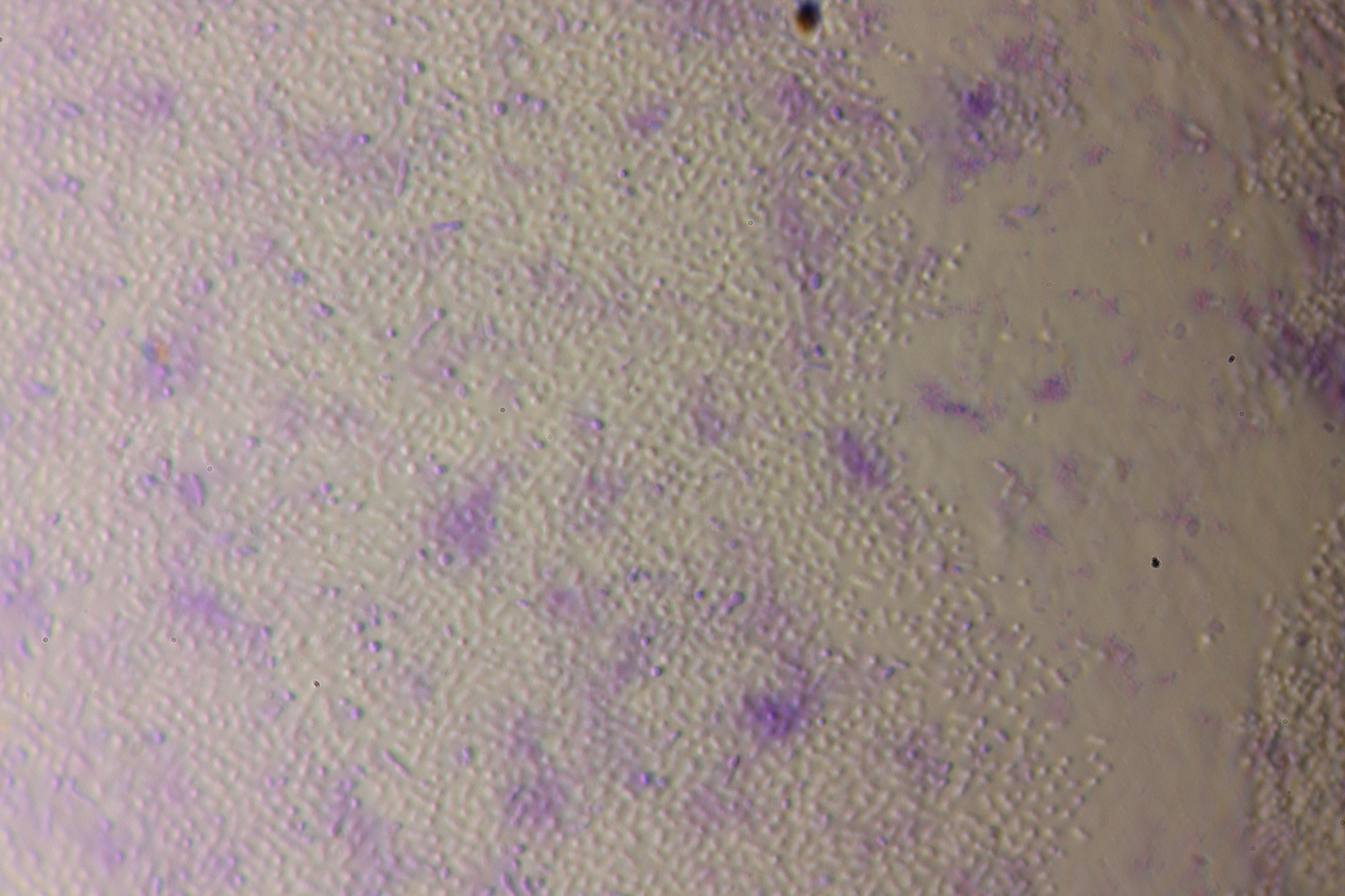 4 fermented grapes after 2 months