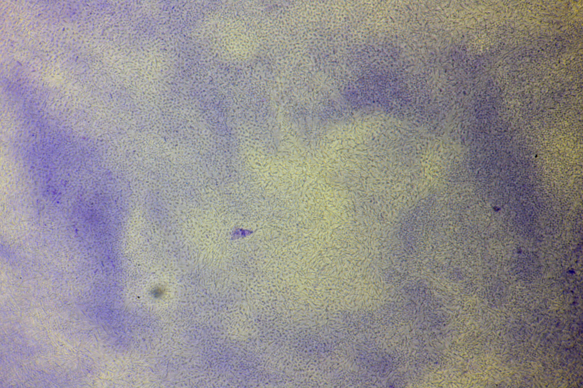 Fermented grapes after 4 months, beginning training jelly