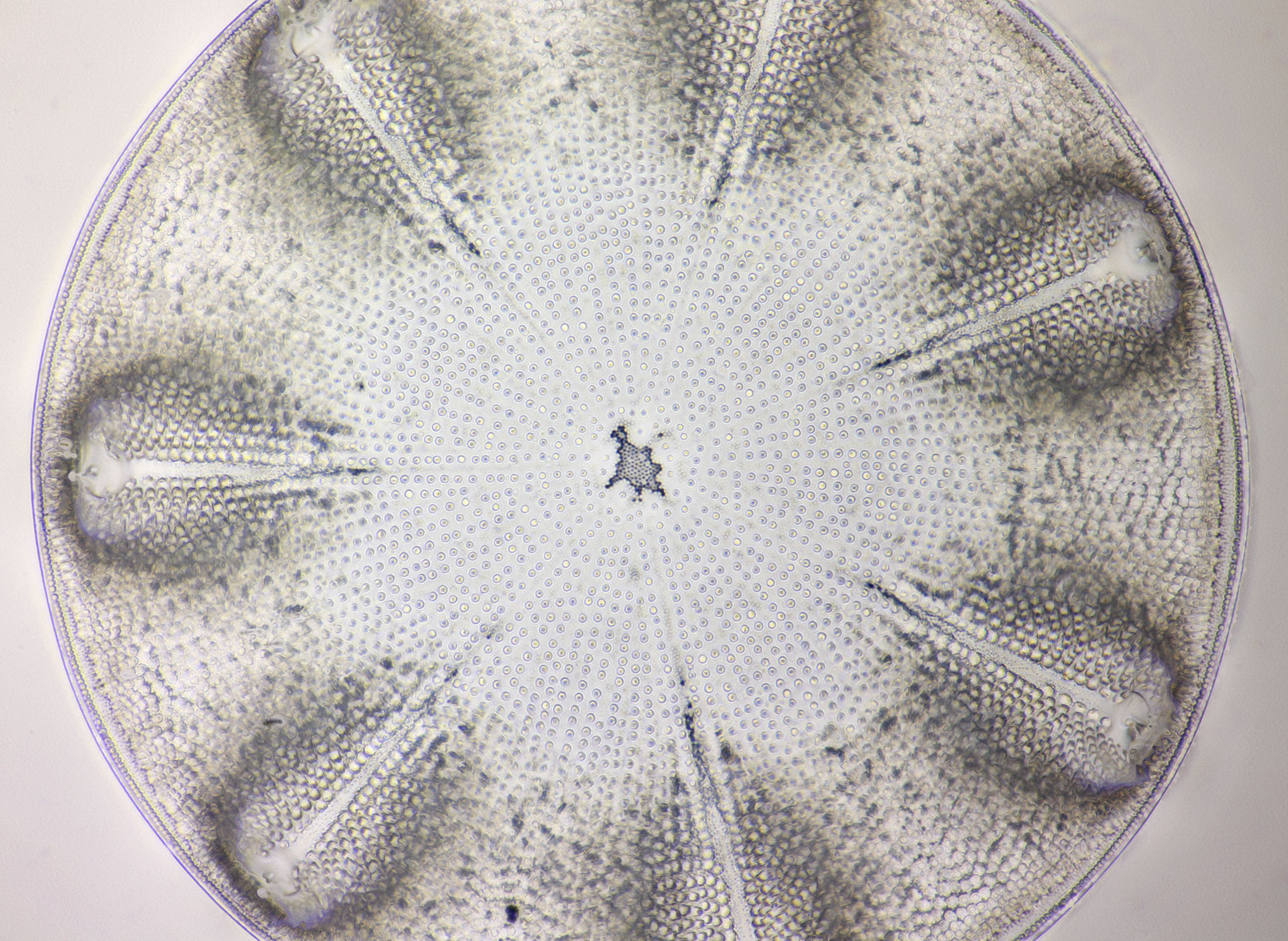 diatom Aulacodiscus janischii, stack