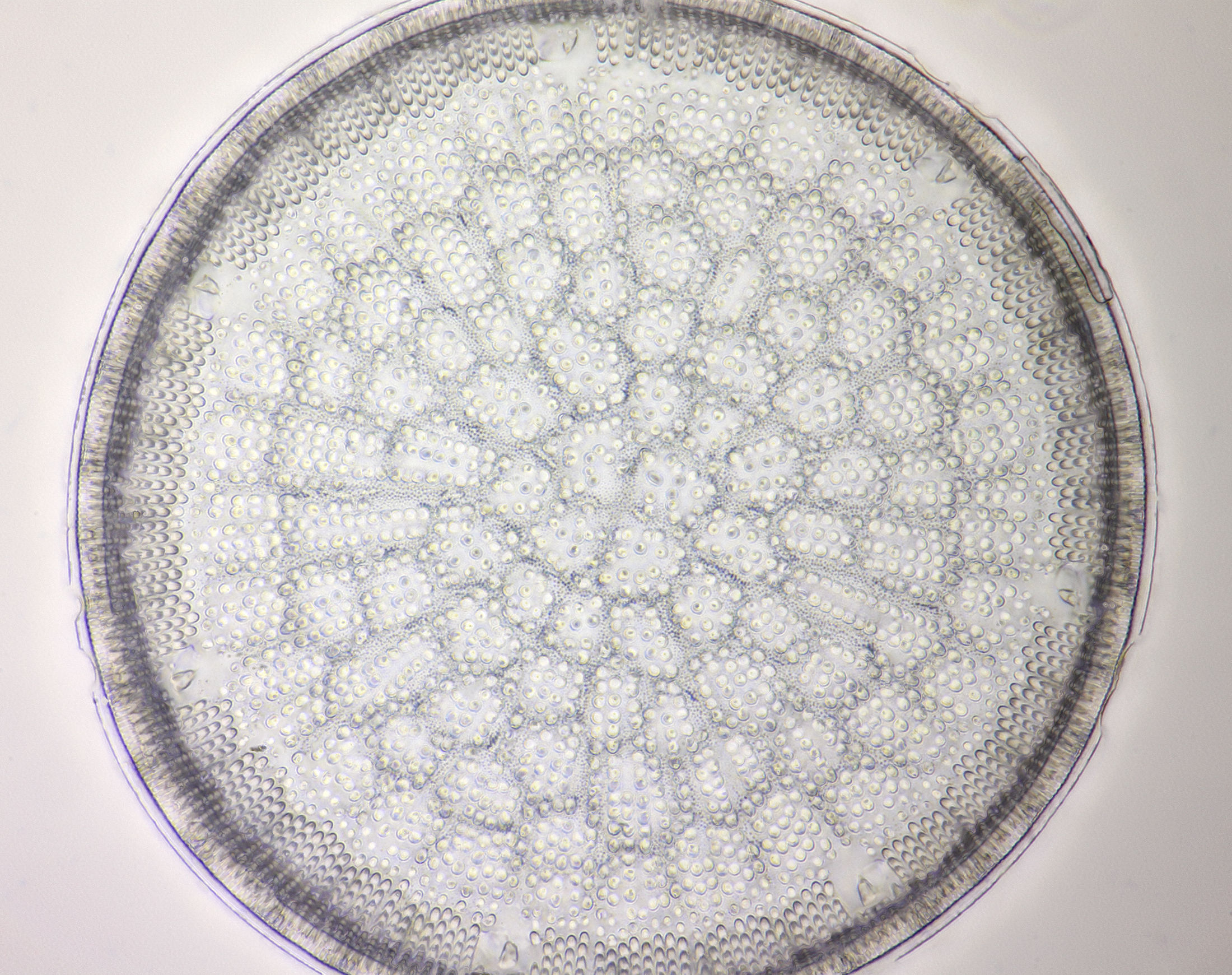 Aulacodiscus reticulatus, stack