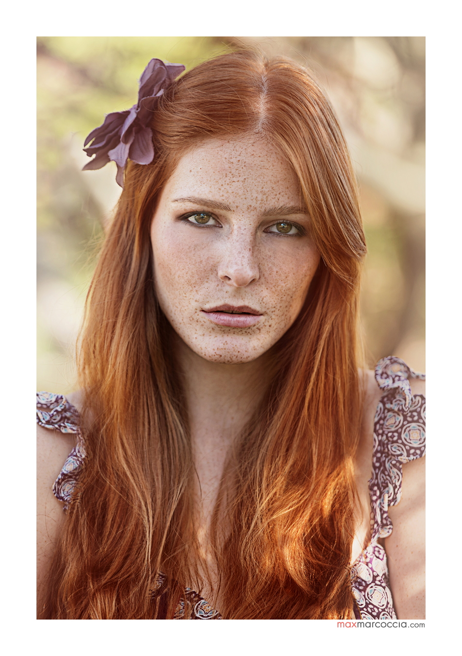 My beautiful freckles