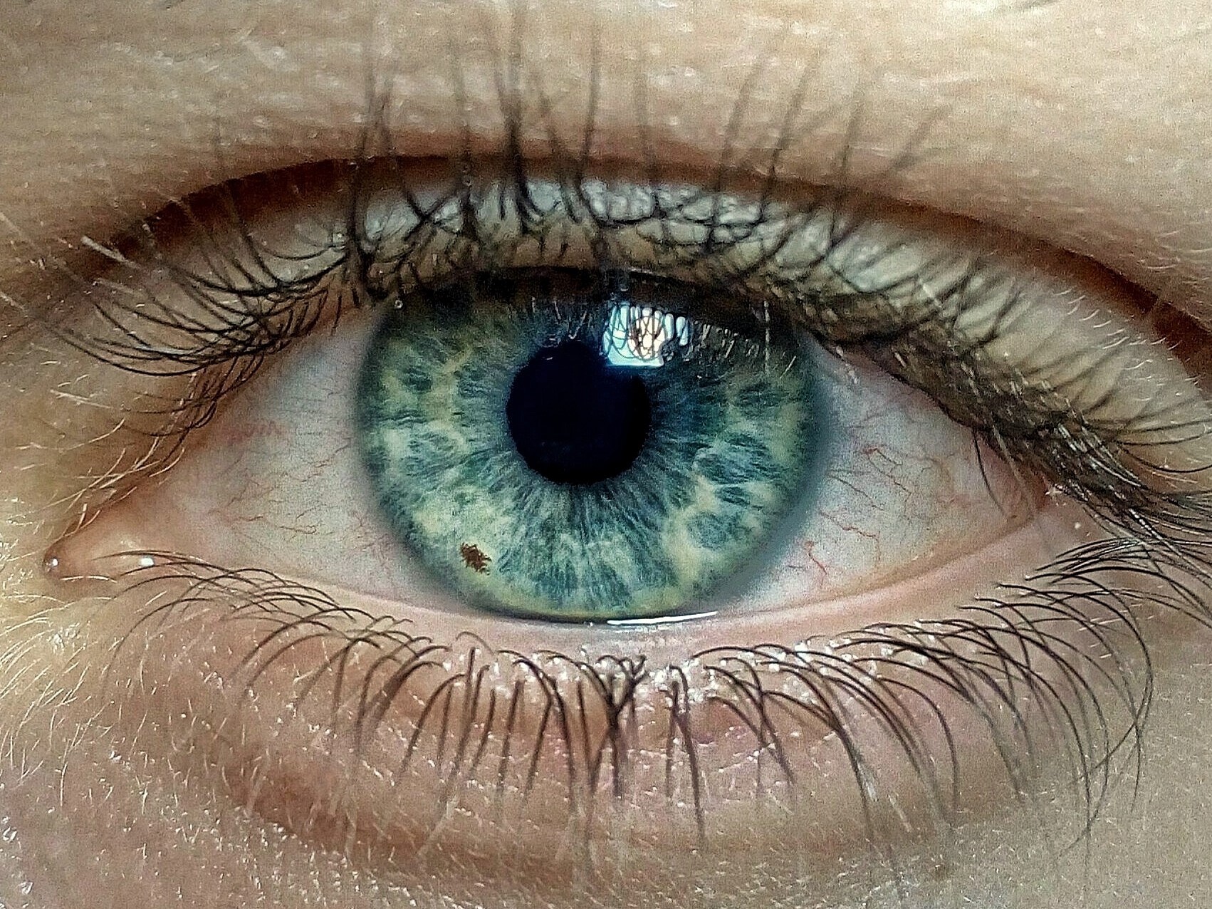 eye
