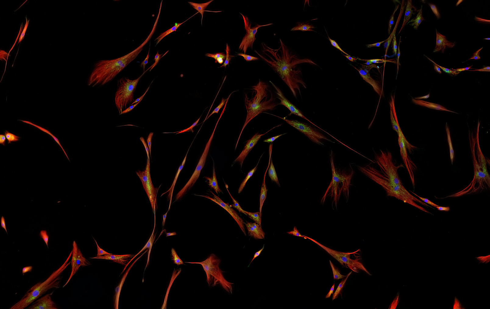 Fibroblasts