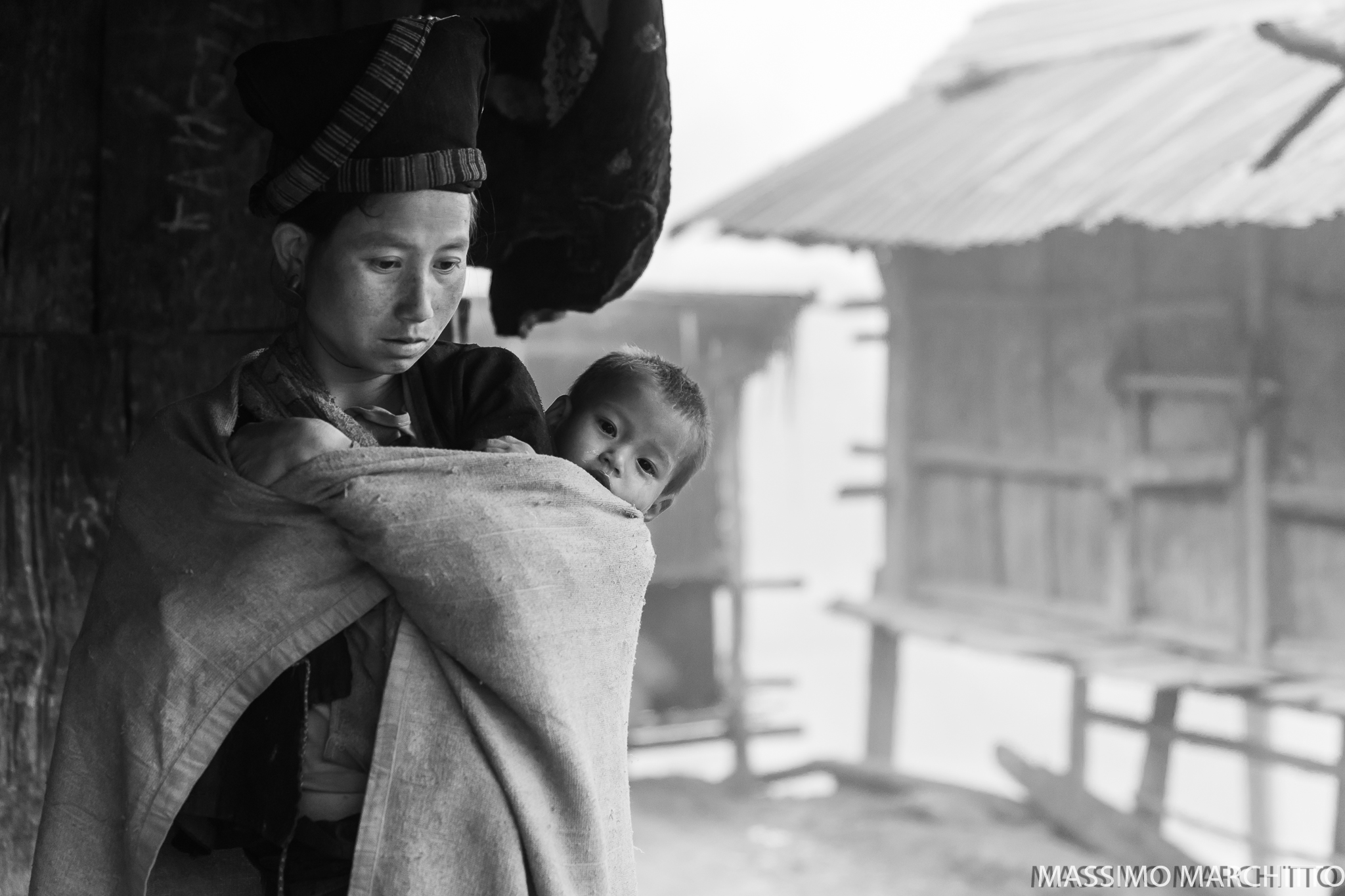 Sore Humanity. Mouchi Village, Boun Tai, North Laos