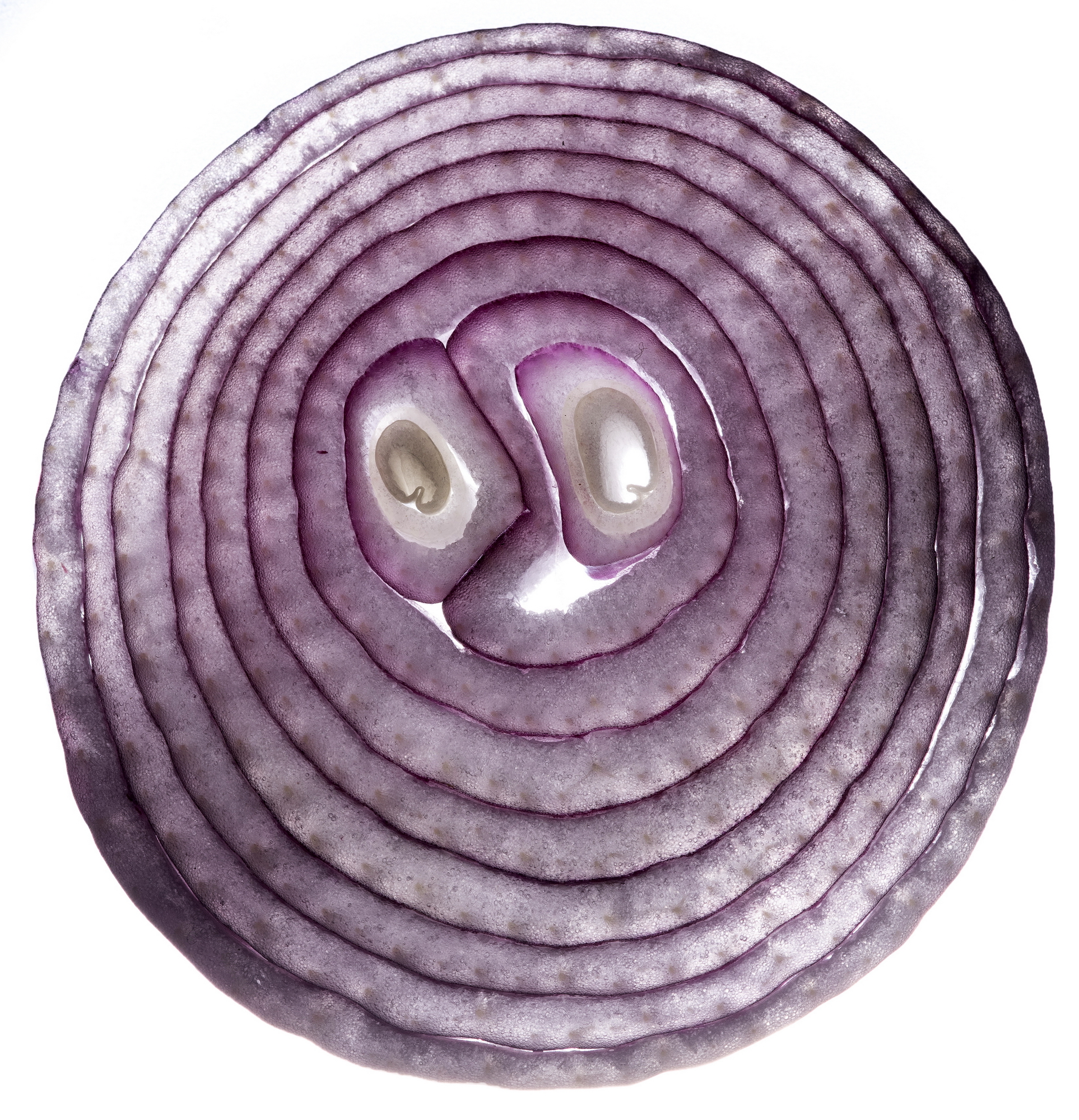 Cipolla