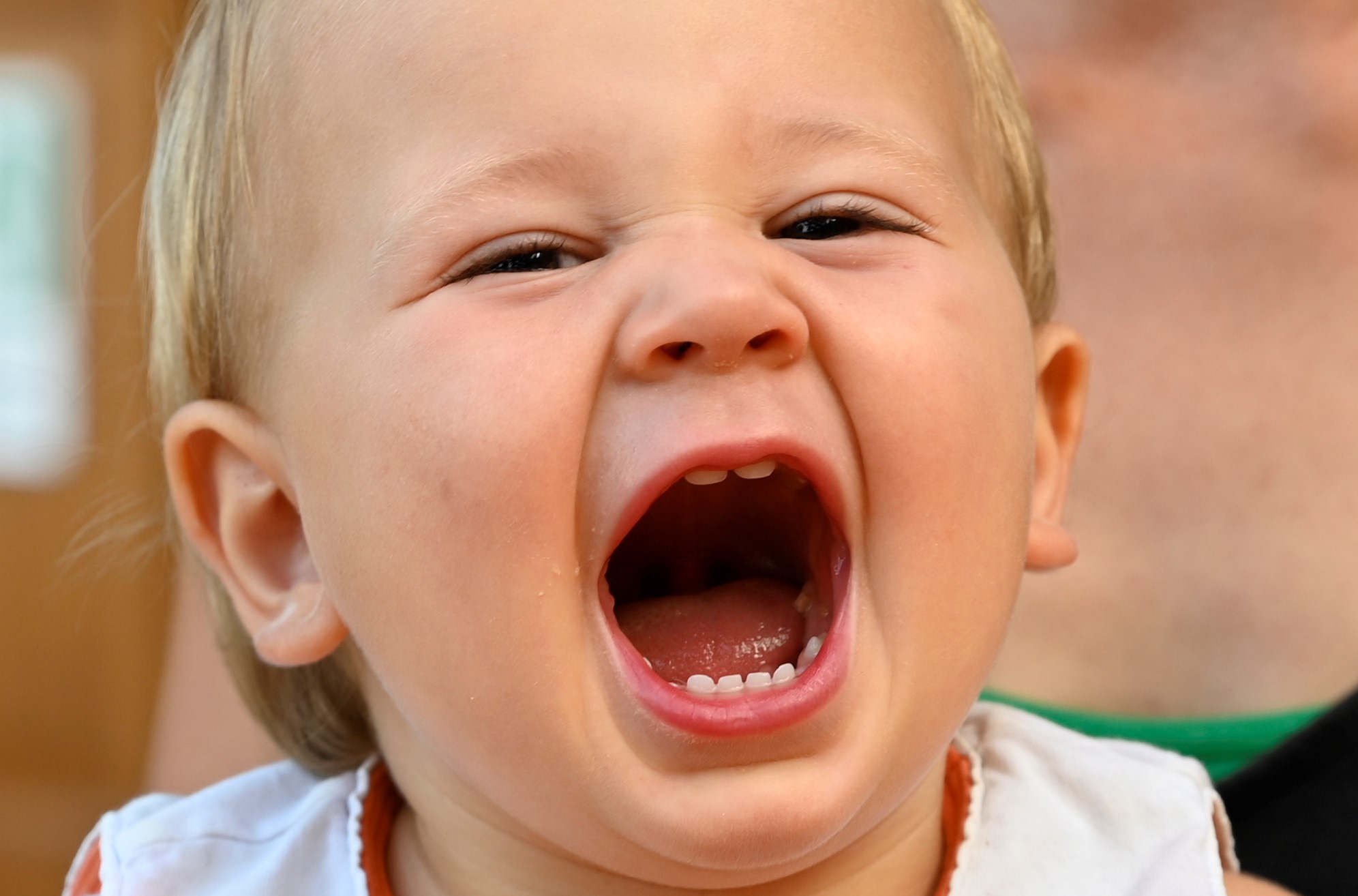 Mostrami i dentini...