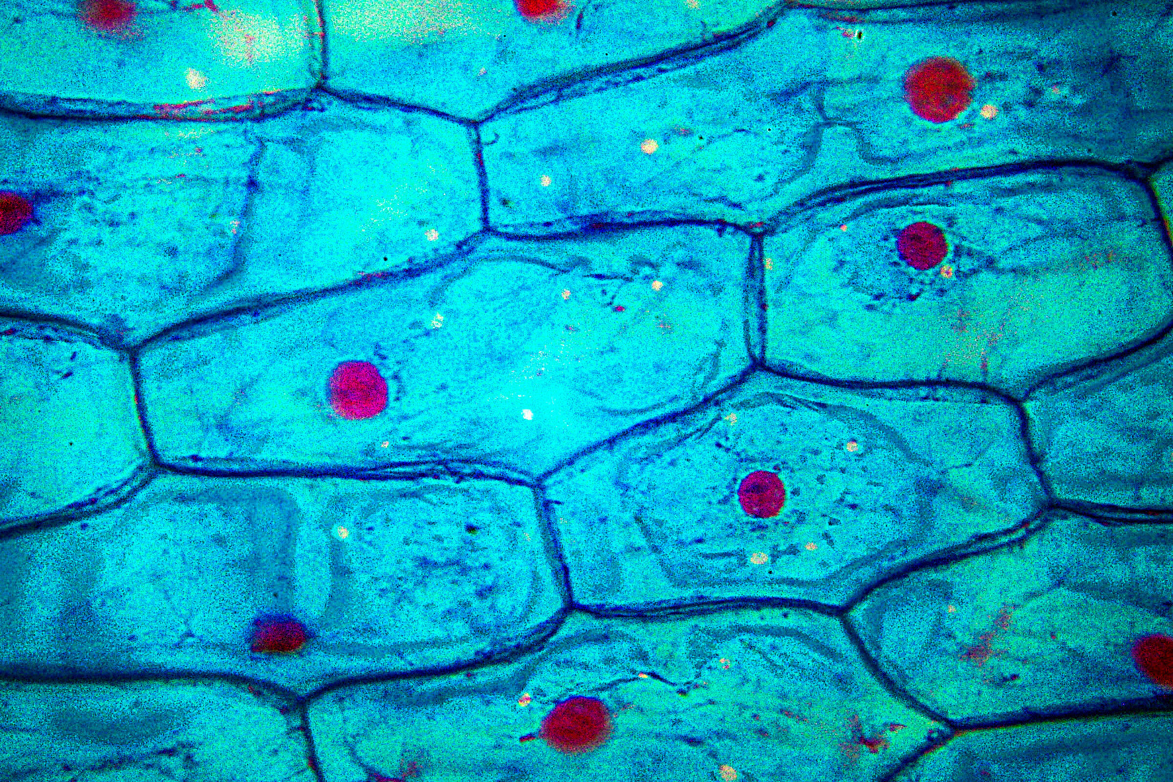 onion cells