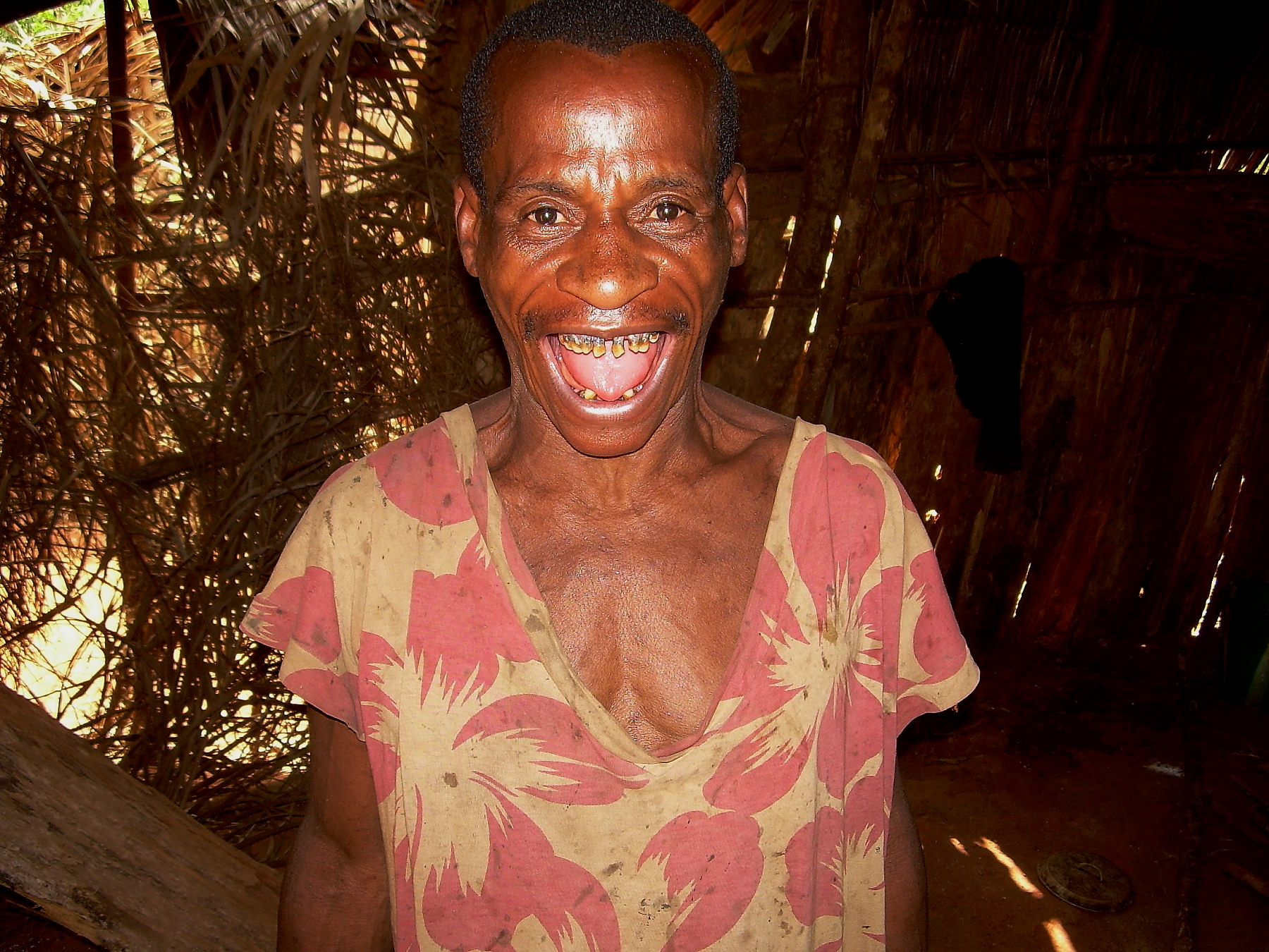 Pigmeo ,Bangui , scansione