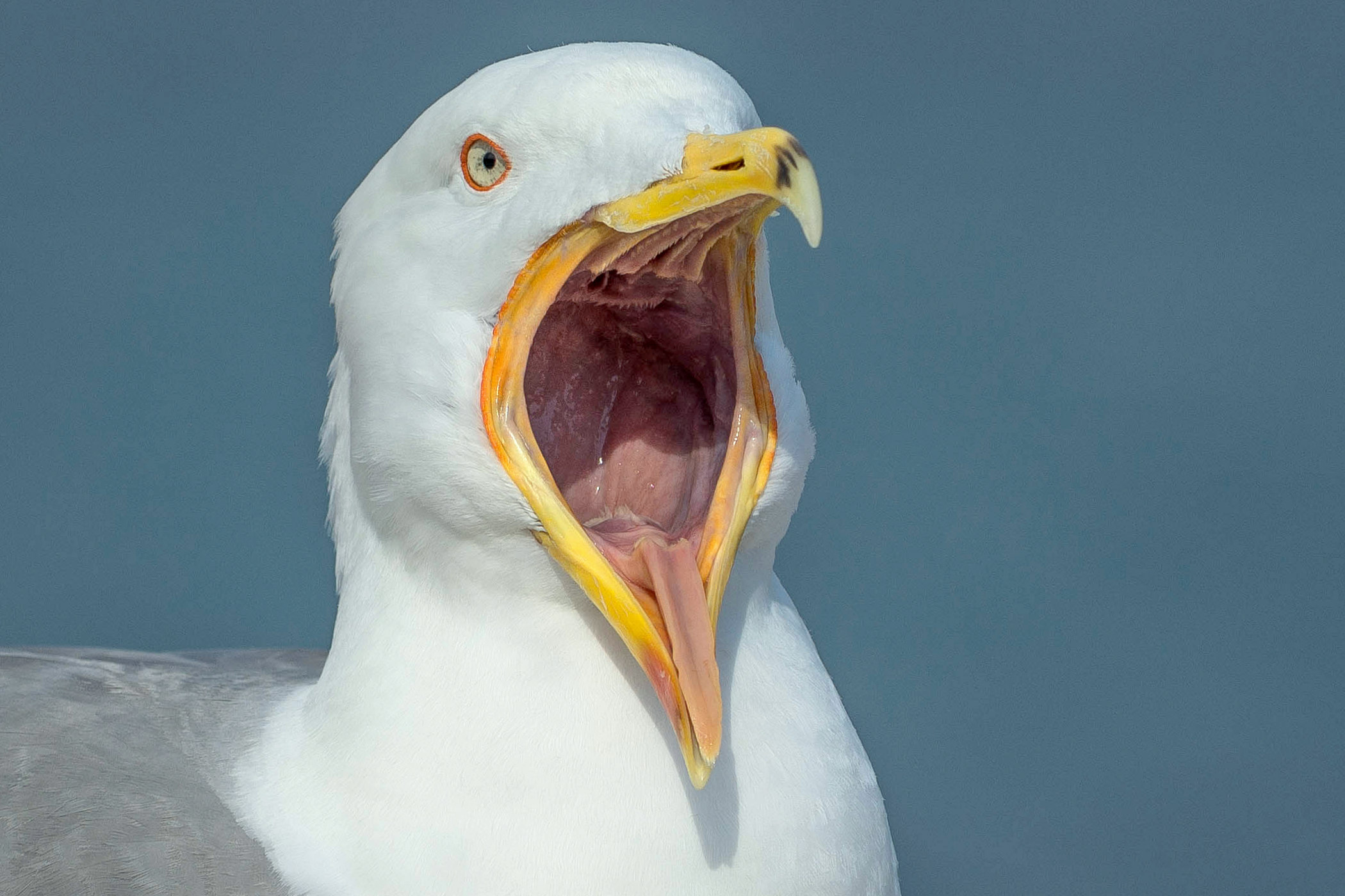 Tonsils and Adenoids control ok ..............